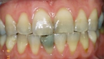 Atlantic Dental Healthcare - Before & After