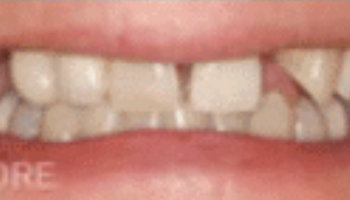 Atlantic Dental Healthcare - Before & After