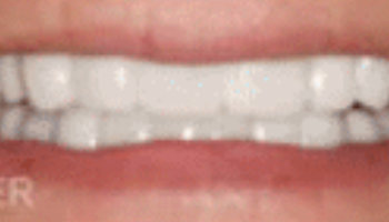 Atlantic Dental Healthcare - Before & After