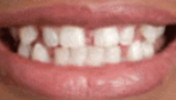 Atlantic Dental Healthcare - Before & After