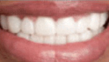 Atlantic Dental Healthcare - Before & After