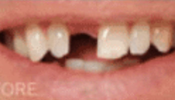 Atlantic Dental Healthcare - Before & After