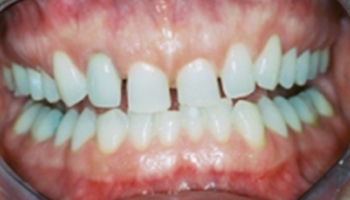 Atlantic Dental Healthcare - Before & After
