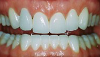 Atlantic Dental Healthcare - Before & After