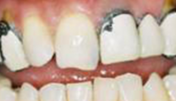 Atlantic Dental Healthcare - Before & After