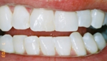 Atlantic Dental Healthcare - Before & After