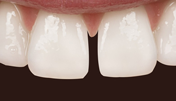 Atlantic Dental Healthcare - Before & After