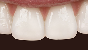 Atlantic Dental Healthcare - Before & After