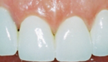 Atlantic Dental Healthcare - Before & After