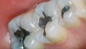 Atlantic Dental Healthcare - Before & After