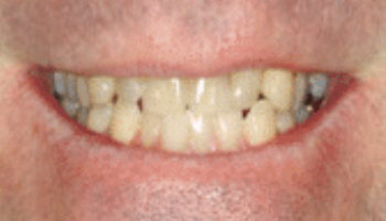 Atlantic Dental Healthcare - Before & After