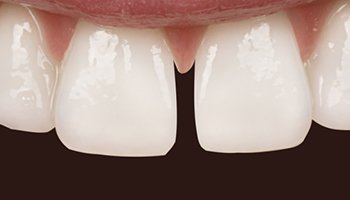 Atlantic Dental Healthcare - Before & After