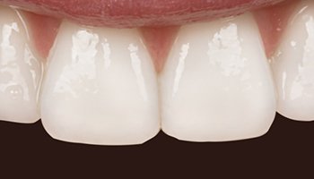 Atlantic Dental Healthcare - Before & After
