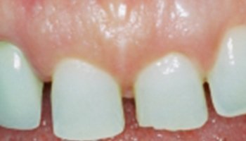 Atlantic Dental Healthcare - Before & After