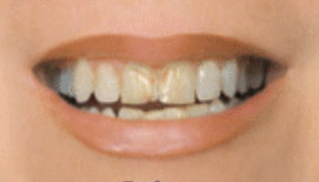 Atlantic Dental Healthcare - Before & After