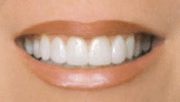 Atlantic Dental Healthcare - Before & After