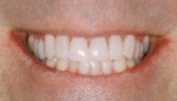 Atlantic Dental Healthcare - Before & After