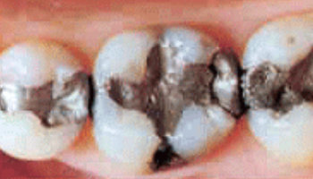 Atlantic Dental Healthcare - Before & After