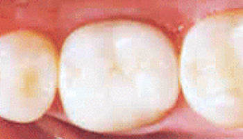 Atlantic Dental Healthcare - Before & After